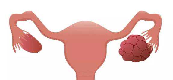 代孕公司有哪些,做广州试管婴儿痛在哪里？立即咨询！